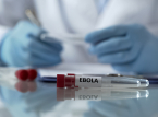 Naniniwala ang World Health Organization (WHO) na ang bakuna para sa pinakabagong strain ng Ebola ay maaaring tumagal ng siyam na buwan bago maihanda